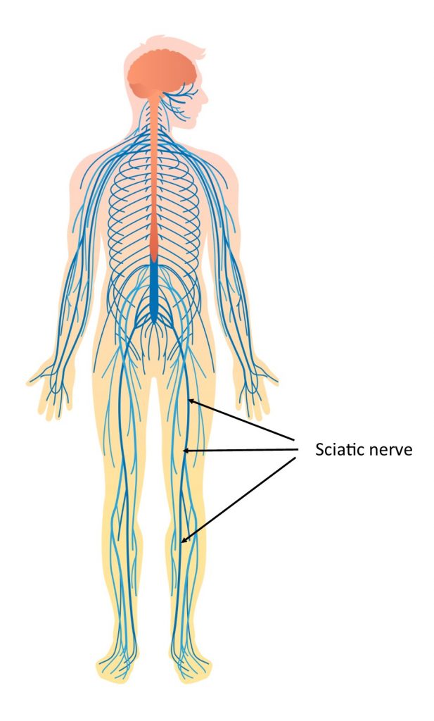 A simple understanding of sciatica - the anatomy involved - Living Well